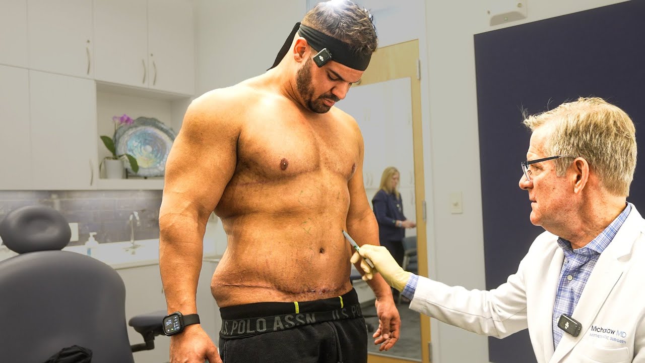 Операция по удалению обвисшей кожи на боках уже здесь.