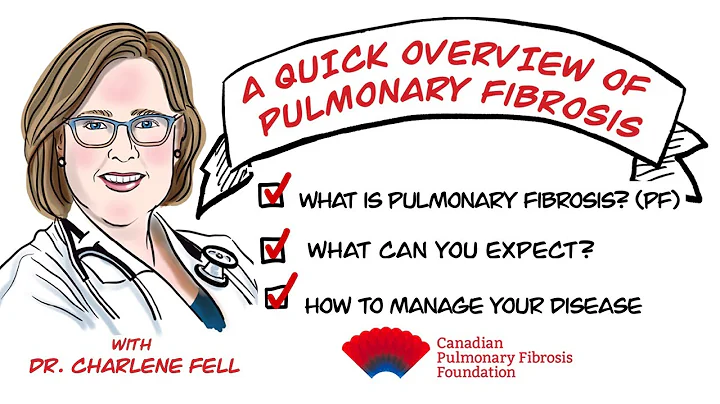 So You've Been Diagnosed with Pulmonary Fibrosis...What'...  Next?