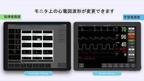 TruVent Quick Start Guide    TruMonitor 基本操作