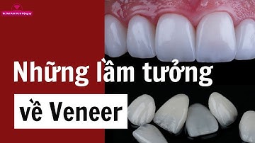 Những lầm tưởng về veneer | Tt niềng răng quốc tế Diamond