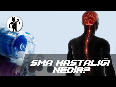 SMA Hastalığı Nedir?