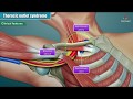 Thoracic outlet syndrome ( Part-2 ) Animation : Clinical Features ,  Diagnosis and Treatment