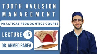 Lecture 15 : Tooth Avulsion Management | كورس بيدو عملي screenshot 3