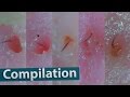 [Compilation] Plucking Tiny Hairs left in the Pores after Removing Blackheads Close Up