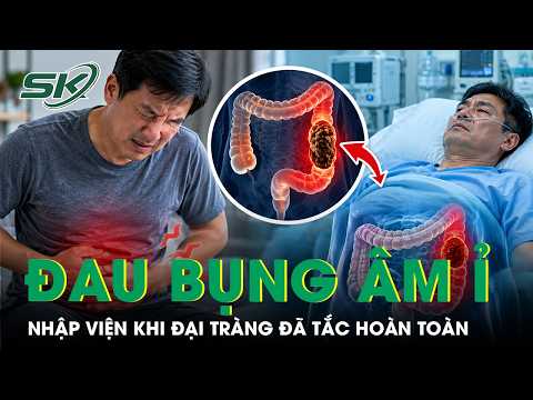 Man hospitalized with total colon obstruction after a month of dull abdominal pain | SKDS