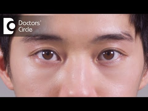 Video: Why Is The Face Swollen