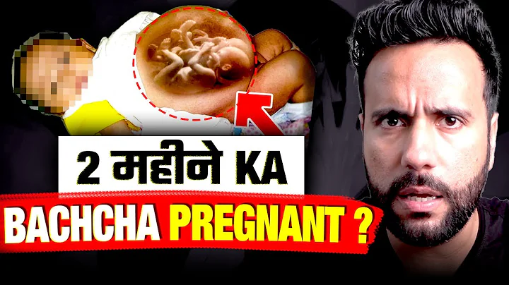 A Rare Medical Condition I Fetus In Fetu I Case Study By Ashu Ghai