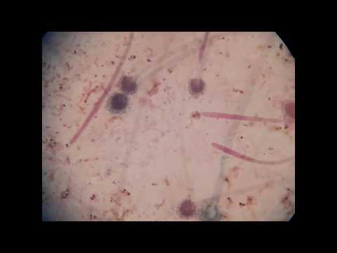 Video: Forskjellen Mellom Hyphae Og Mycelium
