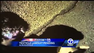 Attorney: No one can pass a sobriety test when his testicle is shattered