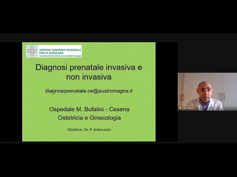 Video: Studi Di Espressione Di Microarray Sul Midollo Osseo Di Pazienti Con Sindrome Di Shwachman-Diamond In Relazione Alla Delezione Del Braccio Lungo Del Cromosoma 20, Altre Anomalie Cr