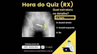 Osso do Quadril - Anatomia Quiz