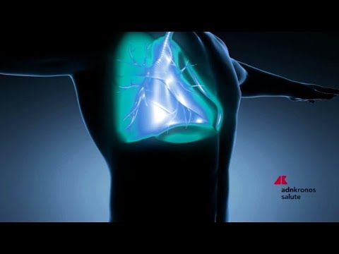 Video Bronchiectasie, esperti a Milano su malattia cronica diffusa ma spesso trascurata