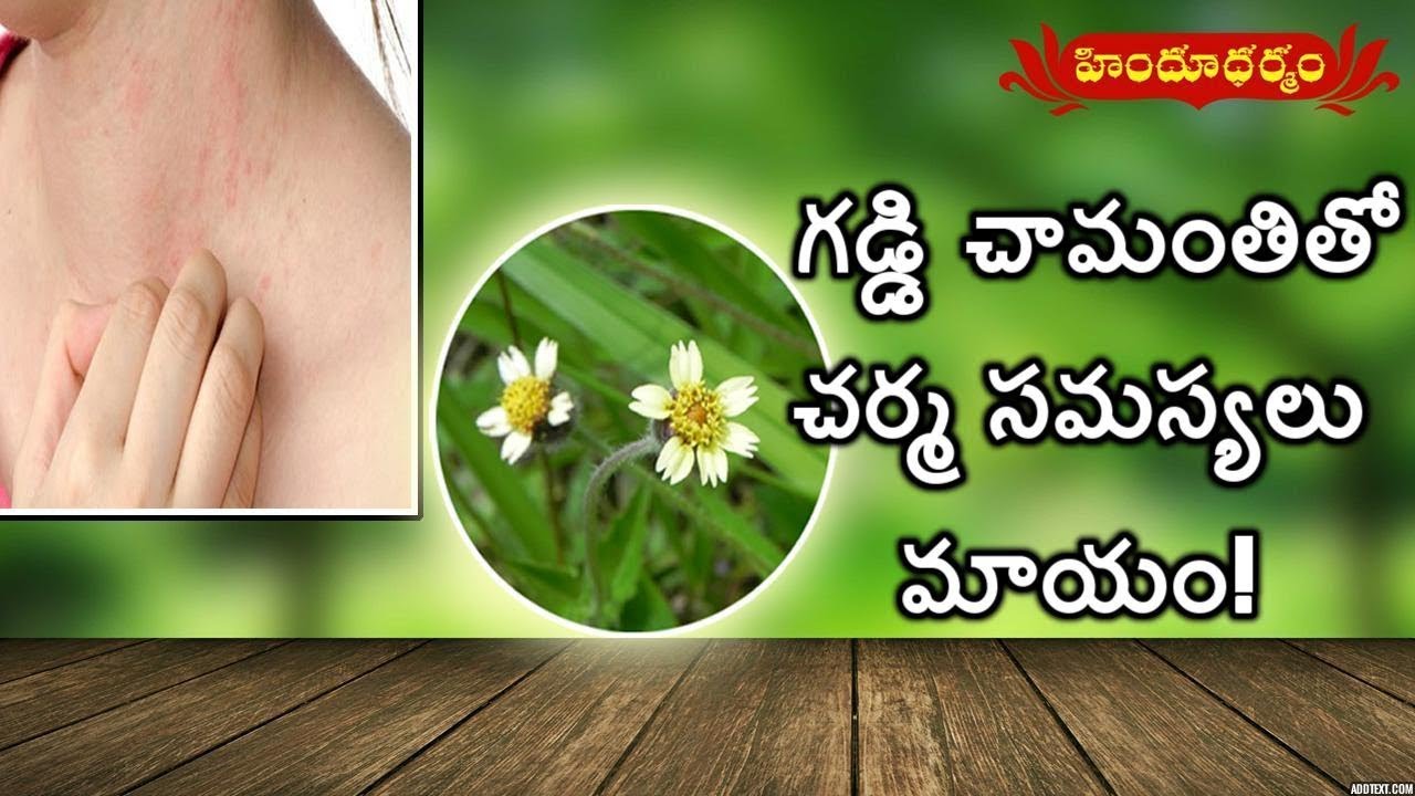 ఎగ్జిమా సమస్యకు గడ్డి చామంతి ఔషధం | Natural Remedy for Eczema(skin rash) | Hindu Dharmam