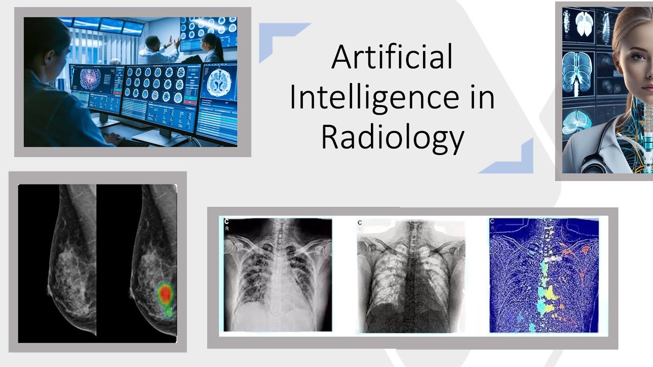 Artificial Intelligence in Radiology - YouTube