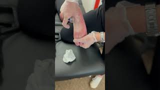 Your Feet Hurt? Try This