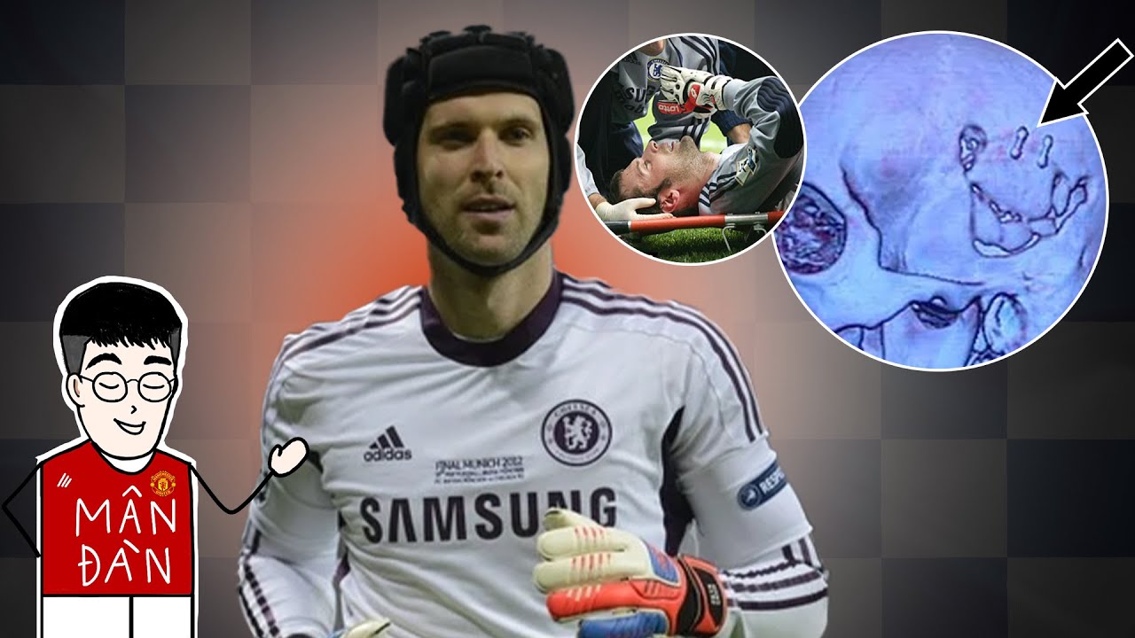 Tất cả về sự sống sót kì diệu của Petr Cech trong 13 phút