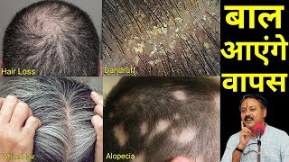 बालों की सभी समस्याओं का समाधान || Hair loss || hair loss cure || hair loss treatment