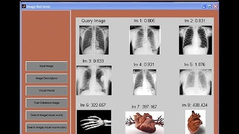 Bag-of-Features Based Medical Image Retrieval by Visual Words Weighting Matlab Project