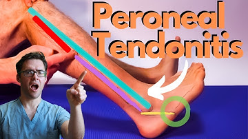 Peroneal Tendonitis Treatment 2024 [Peroneus Brevis & Longus Pain!]