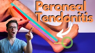 Peroneal Tendonitis Treatment 2024 [Peroneus Brevis & Longus Pain!] screenshot 2