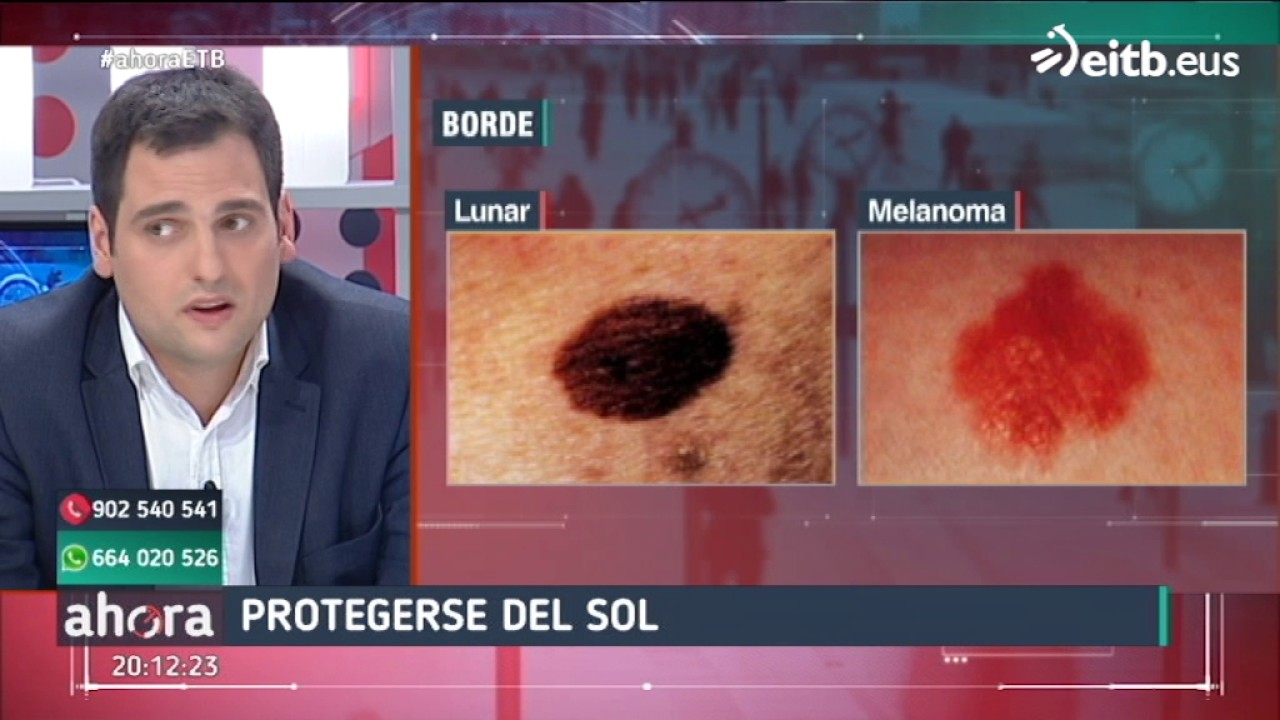 imagenes de lunares benignos y malignos