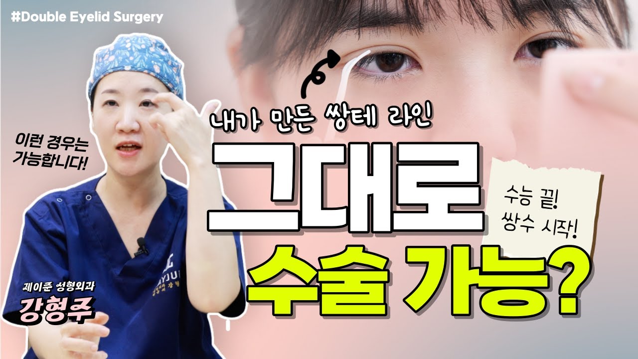 [JAYJUN PHẪU THUẬT THẨM MỸ DA] Các bạn học sinh cấp 3 vừa thi đại học xong, tập trung lại đây! Tôi sẽ chỉ cho các bạn cách để không thất bại khi cắt mí!