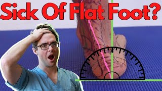 Flat Foot & Overpronation [Top 3 Evidence Based Treatments 2022!]