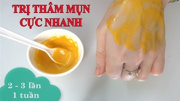 2 Cách Hết Sạch Mụn Thâm Và Sẹo Thần Tốc Chỉ Với 10k