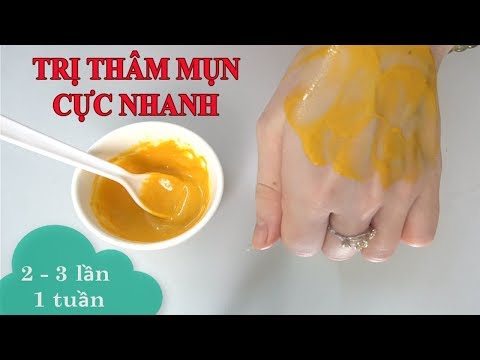 2 Cách Hết Sạch Mụn Thâm Và Sẹo Thần Tốc Chỉ Với 10k