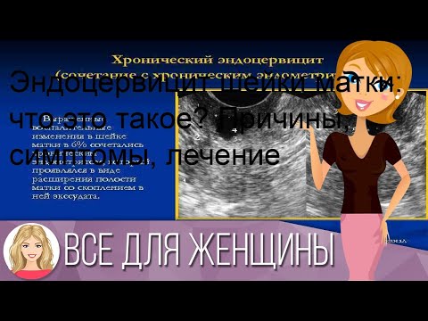 Эндоцервицит шейки матки: что это такое? Причины, симптомы, лечение