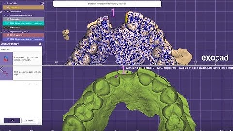 ExoCAD Tutorial - Implant Tooth Mirroring Part 2