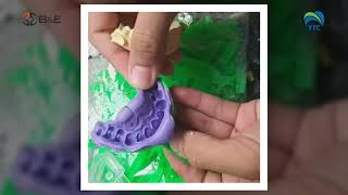 GỠ MẪU THẠCH CAO KHỎI DẤU CAO SU SOFT PUTTY screenshot 5