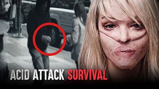 How I Survived an Acid Attack (The Katie Piper Story) by How to Survive 114,189 views 2 months ago 8 minutes, 26 seconds