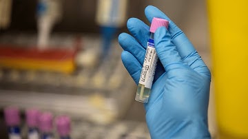 Virtual Roundtable The Expanding Monkeypox Outbreak