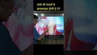 क्या दांतो की सफाई से झनझनाहट होती हे  dentist teeth shorts