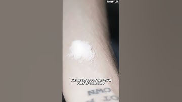 Salt And Ice Can Lead To Severe Burns 😱 #shorts