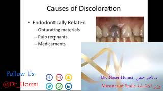 محاضرة عن اسرار و طرق تبييض الاسنان