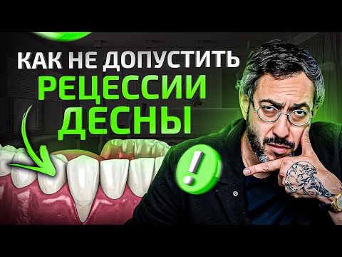 Как избежать рецессии десны и НЕ потерять все зубы