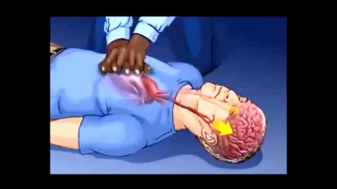 The Continuous Chest Compression CPR - YouTube