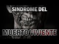 Síndrome del Muerto viviente - ¿Zombies en la vida real?