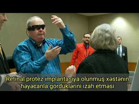 Video: Bionik gözlər varmı?