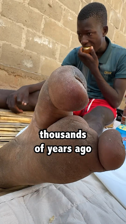 This African Tribe Has Only 2 Toes!