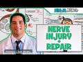 Neurology  nerve injury  repair wallerian degeneration  regeneration