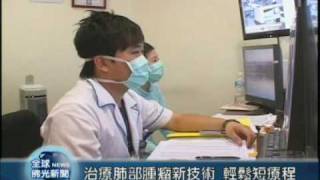 20090616治療肺部腫瘤新技術 輕鬆短療程