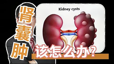 【医学科普】诊断有肾囊肿，该怎么办？Can kidney cyst become tumour? What's the cause? - 天天要闻