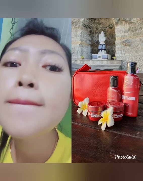 Review pemakaian cream LC BEAUTY DALAM 2 MINGGU.
