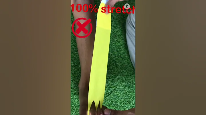 FOOT DROP Treatment [ K- Tape] Easy Trick To Correct #shorts  by Dr. Girish  Physiotherapist