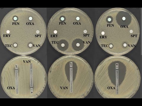 Disk diffusion assay: Kirby-Bauer Test - YouTube