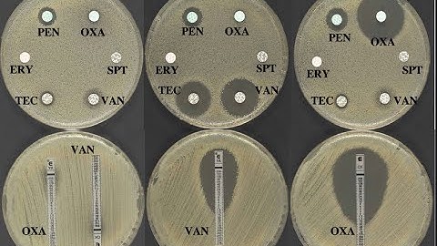 Disk diffusion assay: Kirby-Bauer Test