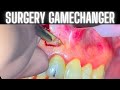 The 1 dental surgery tip its not what you think
